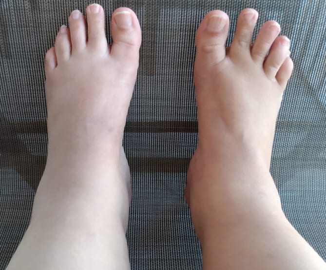 My feet get too hot in tennis shoes and dress shoes down here.